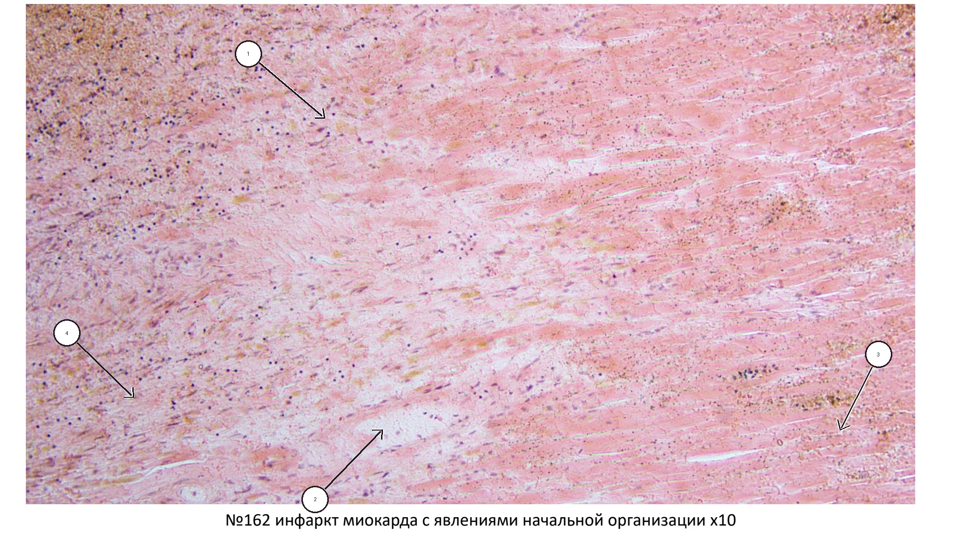 patan01-162-foto-marks.jpg