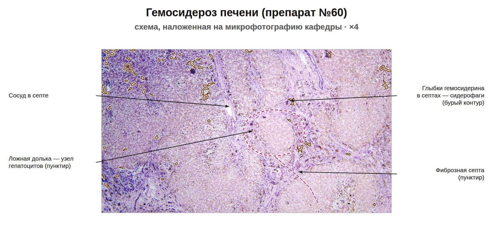 patan06-60-nalozhenie.jpg