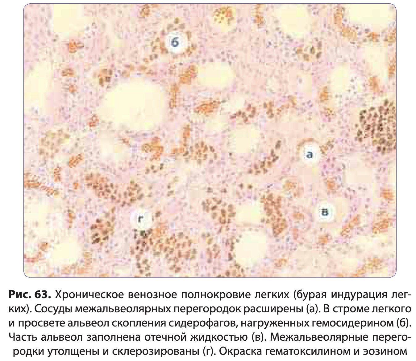 patan06-paukov-63.jpg