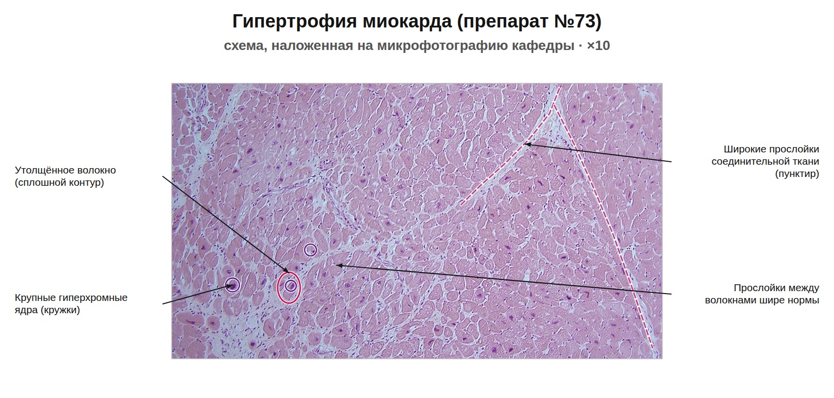 patan07-73-nalozhenie.jpg
